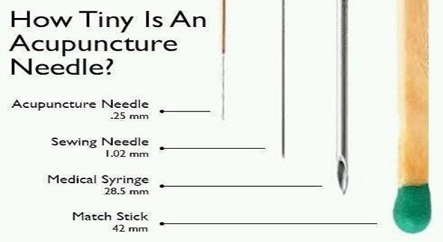 Acupuncture needle Length